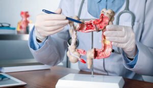 Especialista em Cirurgia Gastro em Campinas